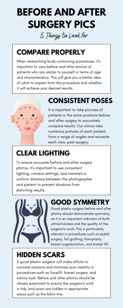 An infographic about assessing body contouring before and after pictures
